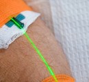 green-intravenous-laser-light-therapy-weber