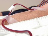 Man receiving ozone blood theray