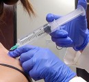 ozone-injection-into-shoulder