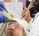 Using an erbium laser to remove skin cancer.