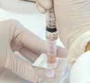 stem-cells-being-drawn-into-syringe