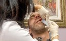 Doctor injects ozone directly into the sinus cavity.