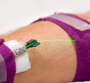 Green intravenous photobiomodulation IV going into patient's arm.