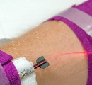 Red intravenous photobiomodulation IV going into patient's arm.