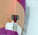 Intravenous red light therapy with small fiber optic.