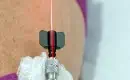 Intravenous red light therapy with small fiber optic.