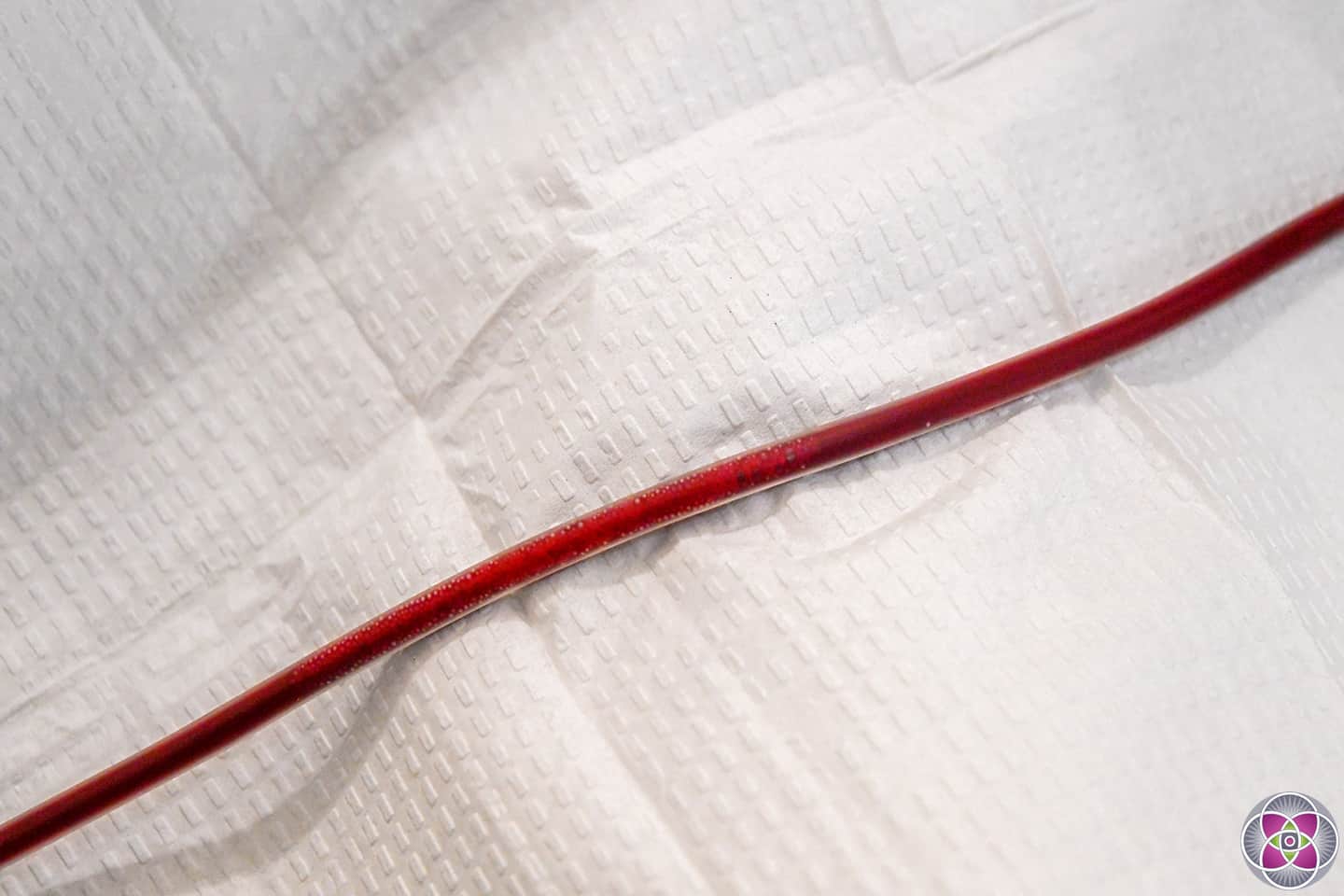 During an EBOO treatment you can see i the IV line all the "gunk" that will be captured by the filter before the purified and ozone infused clean blood in returned to the Long COVID patient.
