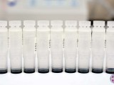 multiple-vials-of-stem-cells-in-row