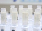 vials-of-stem-cells