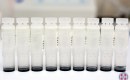 multiple-vials-of-stem-cells-in-row