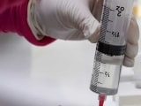 Close-up of vials of mesenchymal stem cell being draw up into syringe.