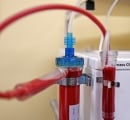 stratos-eboo-purifying-patients-blood