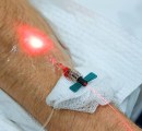 Red intravenous photobiomodulation in patient's arm.