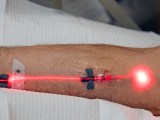 Intravenous red light therapy.