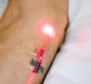 weber-intravenous-red-laser-photodynamic-therapy-ama-regen-med