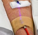 Blue intravenous blood irradiation.