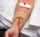Red phototherapy intravenously administered  to a patient