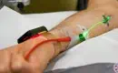 Green intravenous low level light therapy
