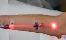 Intravenous red light therapy.