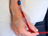 Bright red purified blood returned to patient.